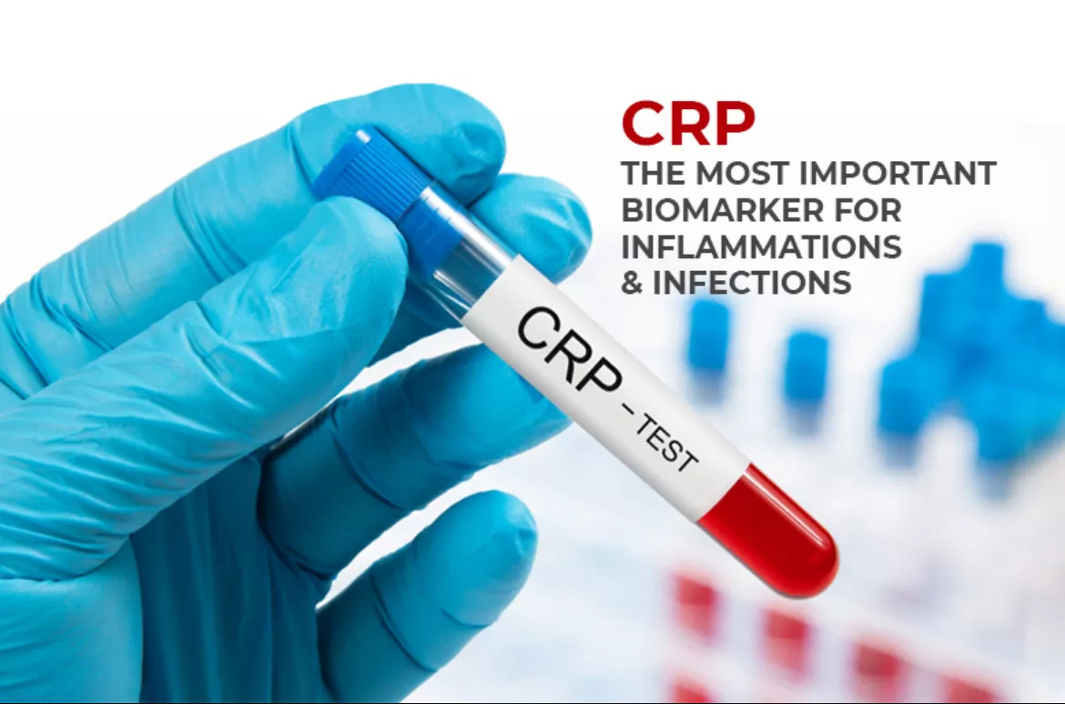 CRP – IMPORTANT INDICATOR IN INFLAMMATION AND INFECTION