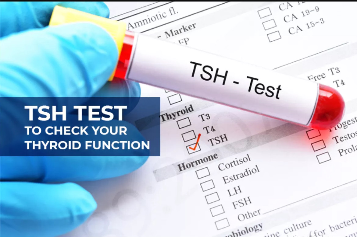 TSH TEST – CHECK THYROID FUNCTION STATUS